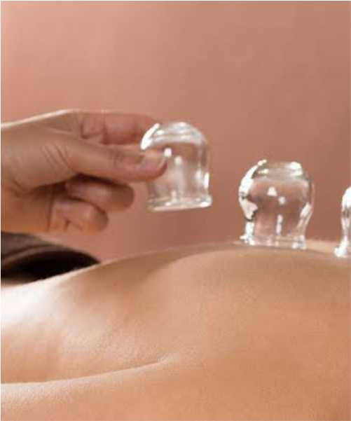 Slimming with Cupping